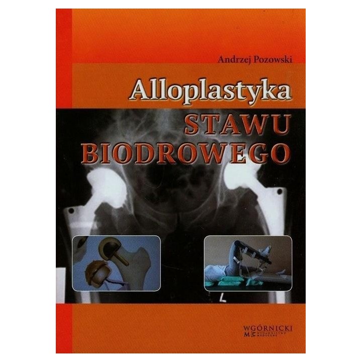 Alloplastyka stawu biodrowego