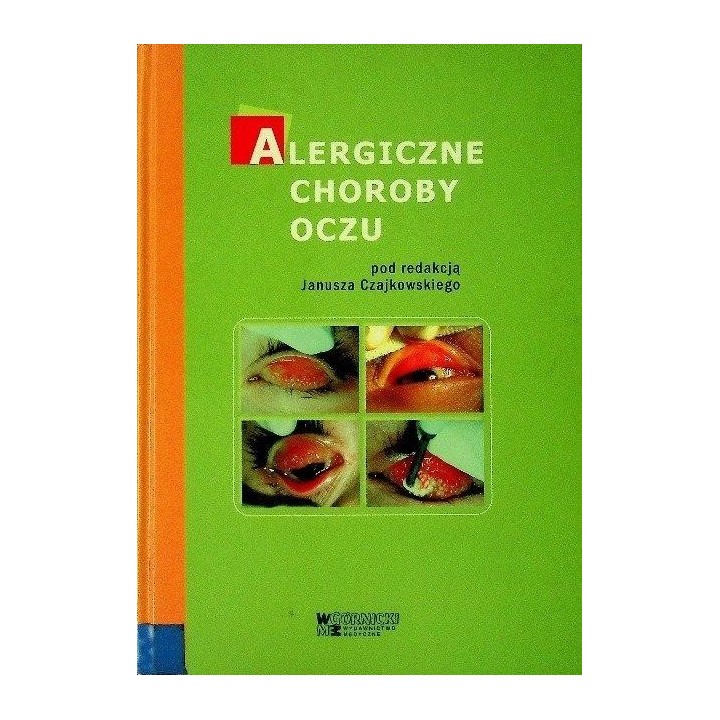 Alergiczne choroby oczu