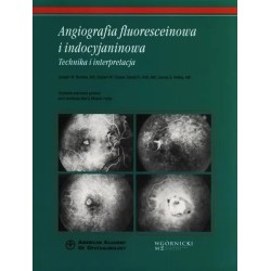 Angiografia fluoresceinowa i indocyjaninowa