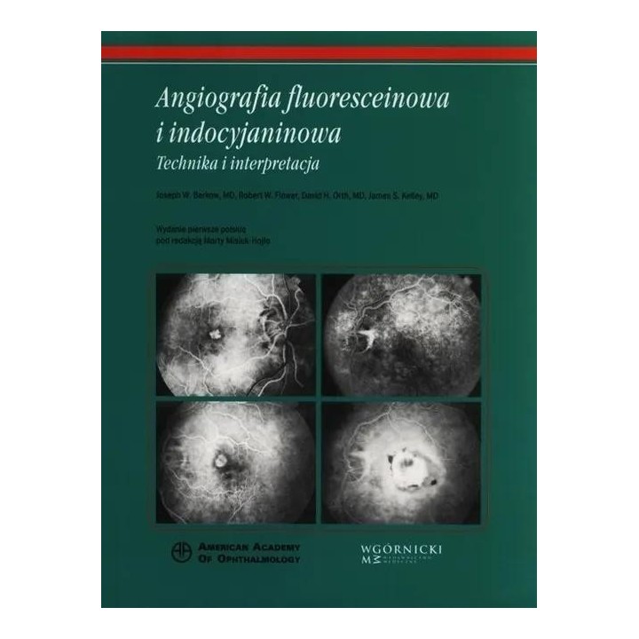 Angiografia fluoresceinowa i indocyjaninowa