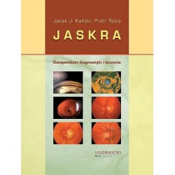 Jaskra. Kompendium diagnostyki i terapii
