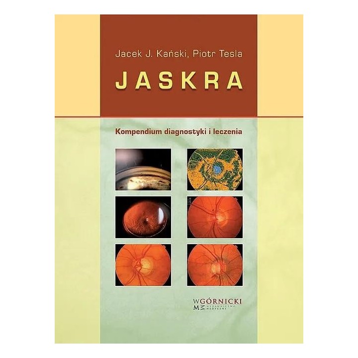 Jaskra. Kompendium diagnostyki i terapii