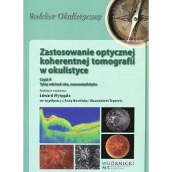 Zastosowanie optycznej koherentnej tomografii cz.2