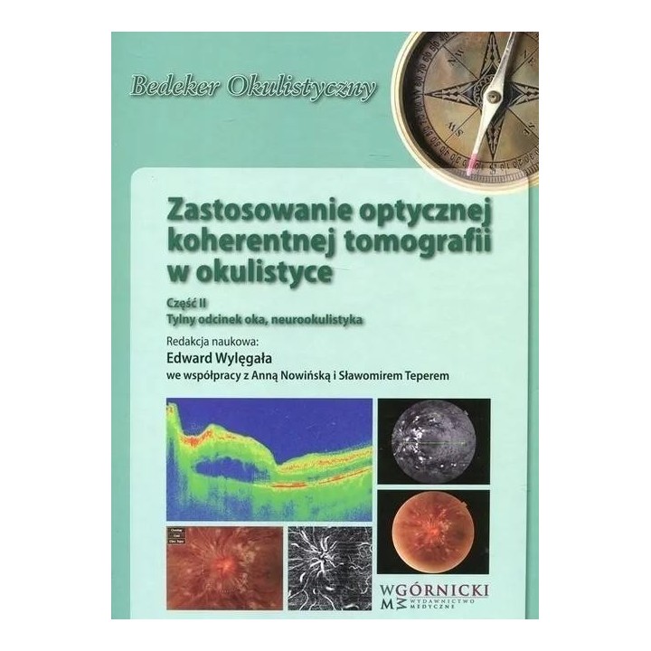 Zastosowanie optycznej koherentnej tomografii cz.2
