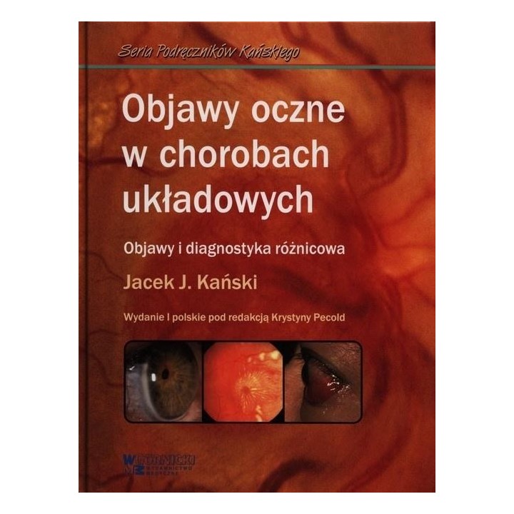 Objawy oczne w chorobach układowych