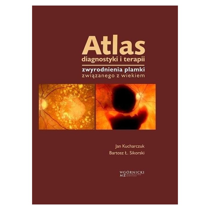 Atlas diagnostyki i terapii zwyrodnienia plamki...