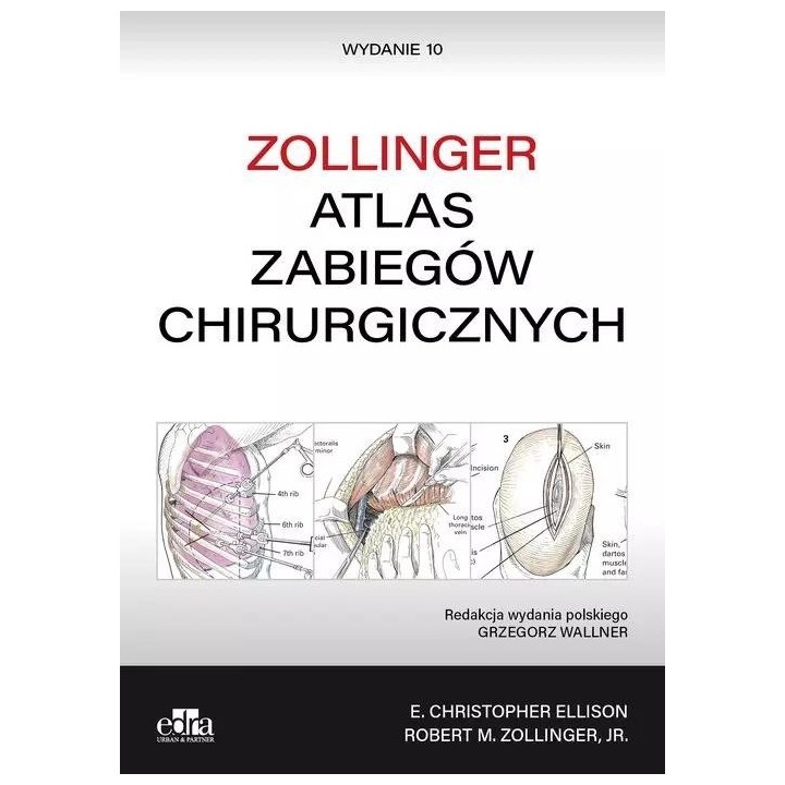 Atlas zabiegów chirurgicznych. Zollinger