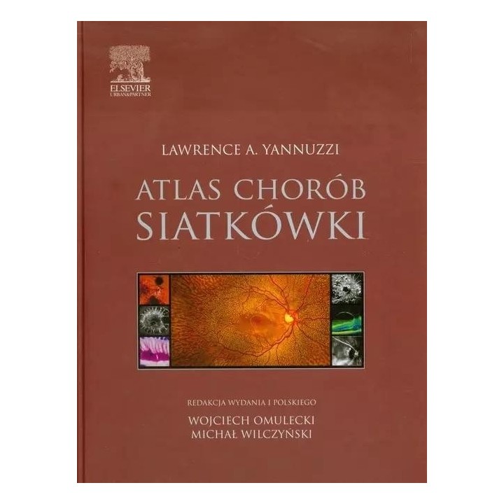 Atlas chorób siatkówki