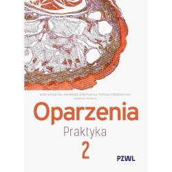 Oparzenia. Praktyka T.2