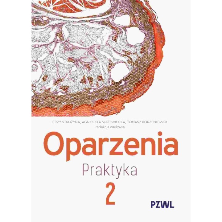 Oparzenia. Praktyka T.2