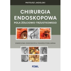 Chirurgia endoskopowa pola żółciowo-trzustkowego