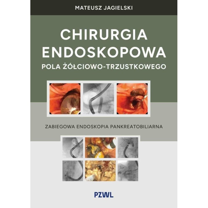 Chirurgia endoskopowa pola żółciowo-trzustkowego