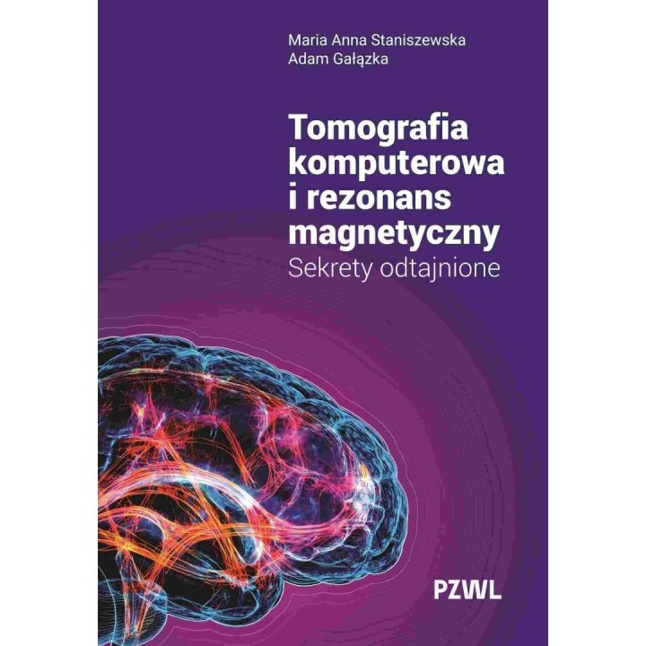 Tomografia komputerowa i rezonans magnetyczny