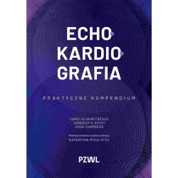 Echokardiografia