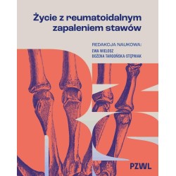 Życie z reumatoidalnym zapaleniem stawów