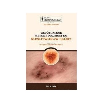 Współczesne metody diagnostyki nowotworów skóry