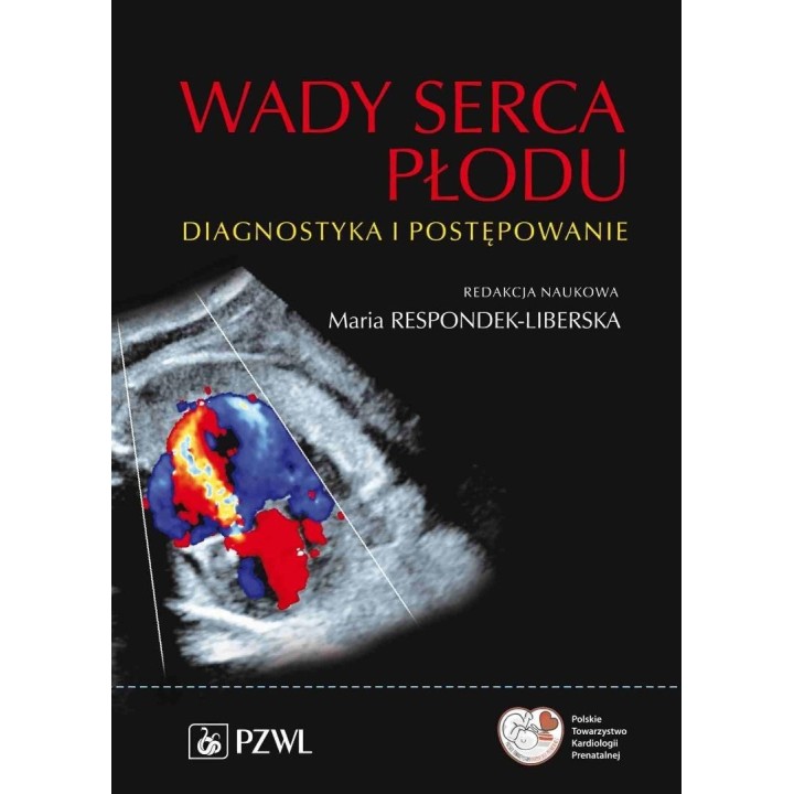 Wady serca płodu. Diagnostyka i postępowanie