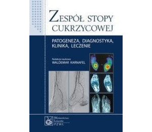 Zespół stopy cukrzycowej