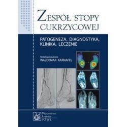 Zespół stopy cukrzycowej