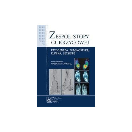 Zespół stopy cukrzycowej