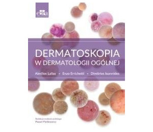 Dermatoskopia w dermatologii ogólnej