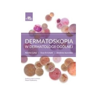 Dermatoskopia w dermatologii ogólnej
