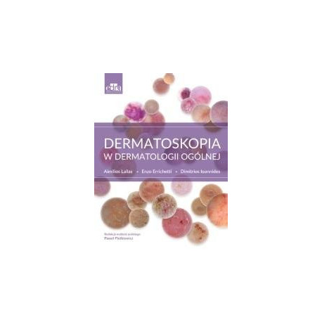 Dermatoskopia w dermatologii ogólnej