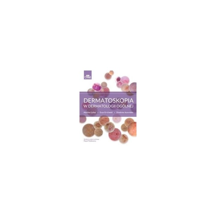 Dermatoskopia w dermatologii ogólnej