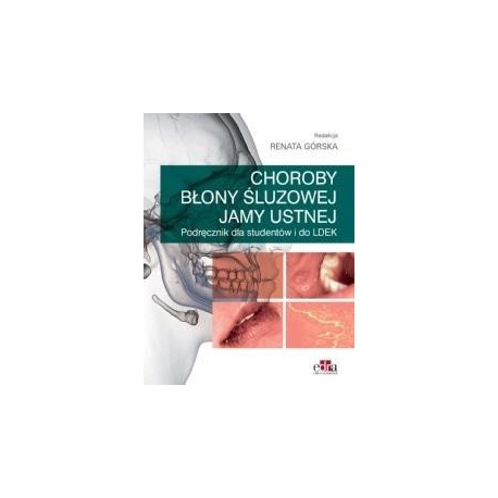Choroby błony śluzowej