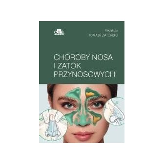 Choroby nosa i zatok przynosowych