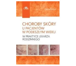 Choroby skóry u pacjentów w podeszłym wieku