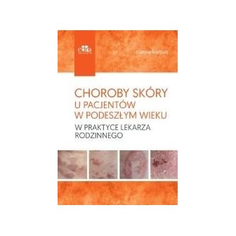 Choroby skóry u pacjentów w podeszłym wieku