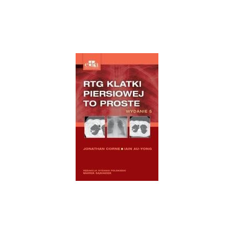 RTG klatki piersiowej