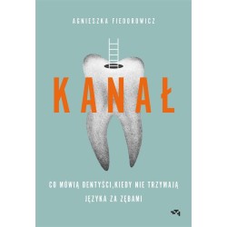 Kanał. Co mówią dentyści,...