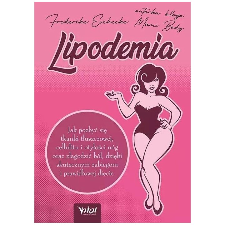 Lipodemia
