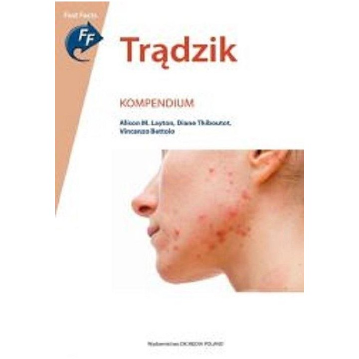 Trądzik. Kompendium