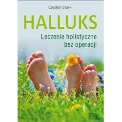 Halluks. Leczenie holistyczne bez operacji