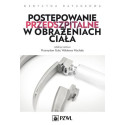 Postępowanie przedszpitalne w obrażeniach ciała