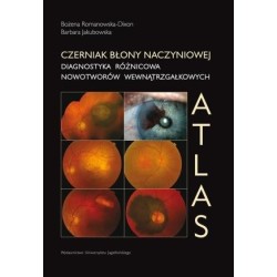 Czerniak błony naczyniowej. Diagnostyka różnicowa